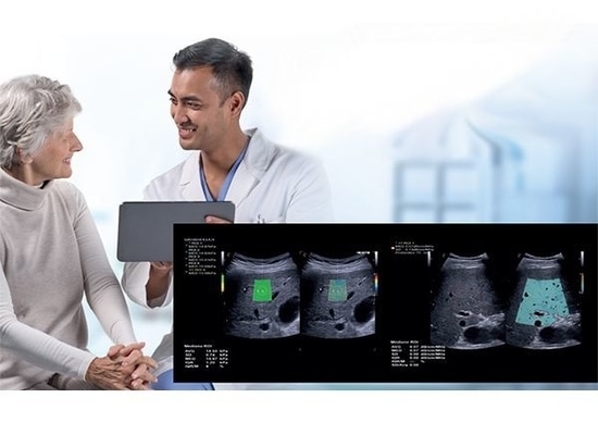 ESAOTE ha presentado hoy en el Congreso Europeo de Radiología (ECR) 2023 de Viena, MyLab™X90, sistema de ultrasonidos premium con Augmented Insight™ que combina un rendimiento excepcional con un fl...