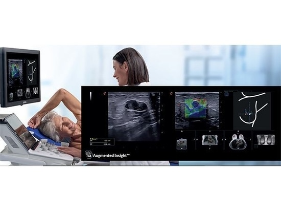 ESAOTE ha presentado hoy en el Congreso Europeo de Radiología (ECR) 2023 de Viena, MyLab™X90, sistema de ultrasonidos premium con Augmented Insight™ que combina un rendimiento excepcional con un fl...