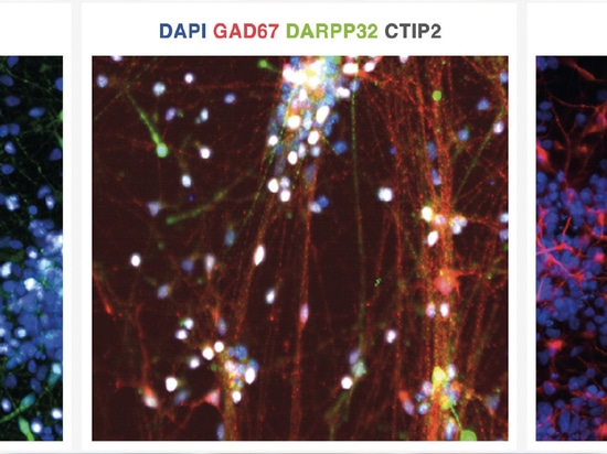 Células progenitoras neuronales para trasplantes