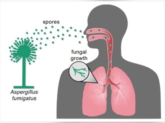 Hongos en los pulmones