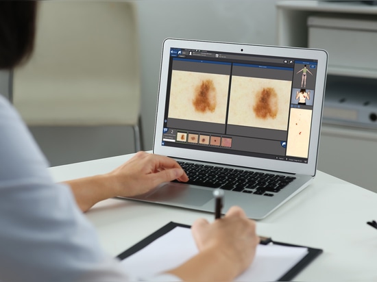 Ofrezca a sus pacientes un seguimiento dermatológico excepcional con Bodymapper E4