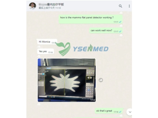 El detector de panel plano para mamografía YSENMED YSFPD-R1012C funciona bien en el hospital de Senegal.