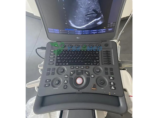 Ecógrafo Doppler en color 4D portátil Comentarios