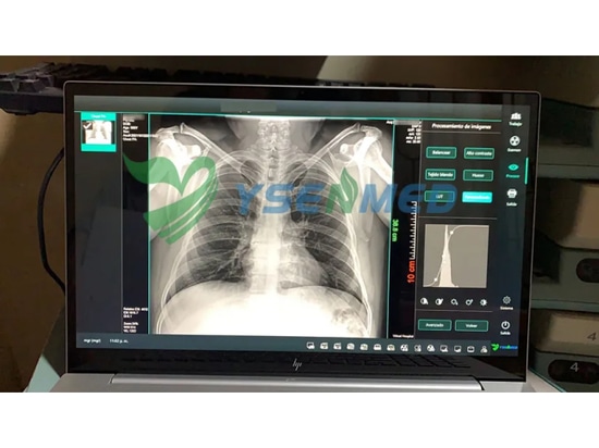 Cliente de Bolivia satisfecho con el detector de panel plano YSENMED YSFPD4343A.