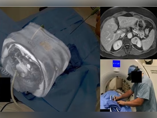 Visualización en tiempo real de la anatomía