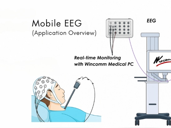 Monitorización móvil de EEG en la UCI con Wincomm WMP-22P | PC médico sin ventilador