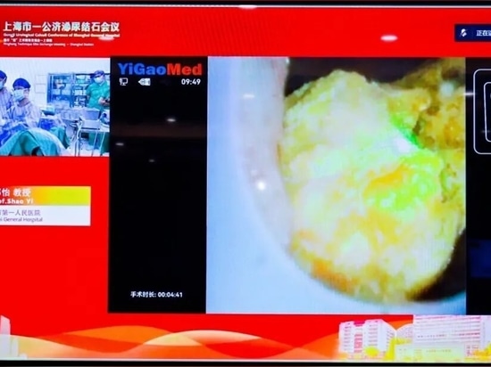 Cirugía en directo realizada por Yi Shao
