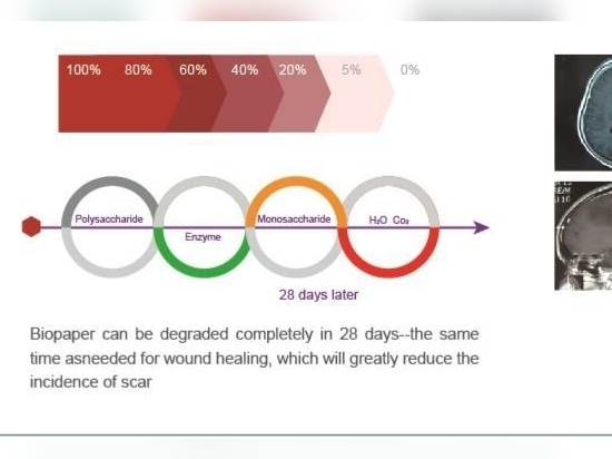 Biopaper ® es un nuevo tipo de material hemostático biodegradable patentado.