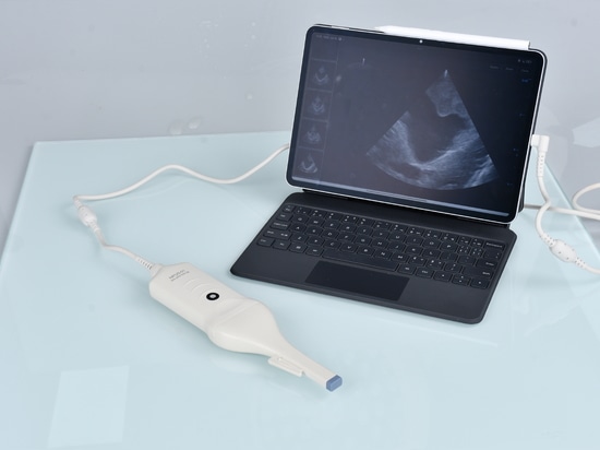 NPUS-01: El ecógrafo portátil diseñado para neurocirugía