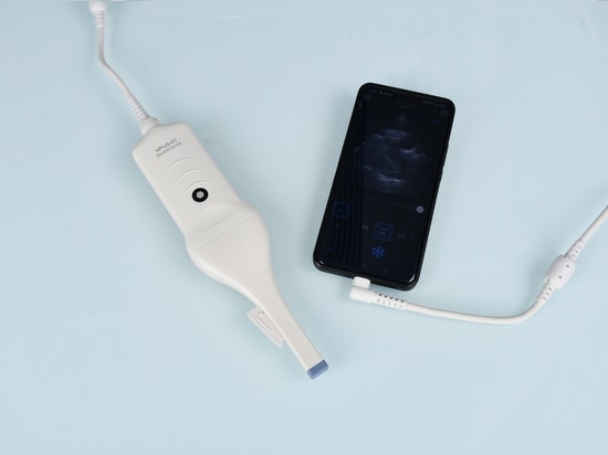 NPUS-01: El ecógrafo portátil diseñado para neurocirugía