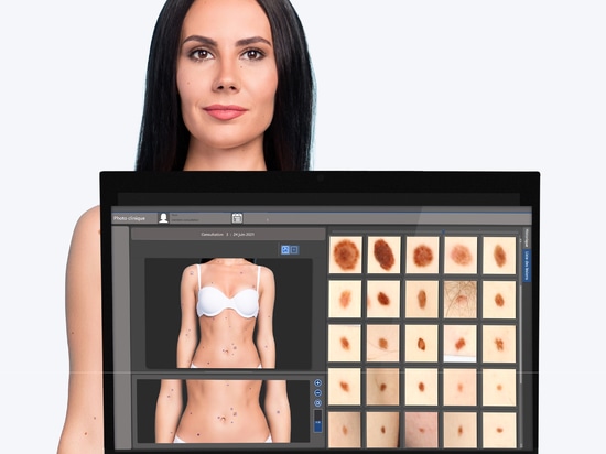 Reduzca los tiempos de espera con el BodyMapper E4