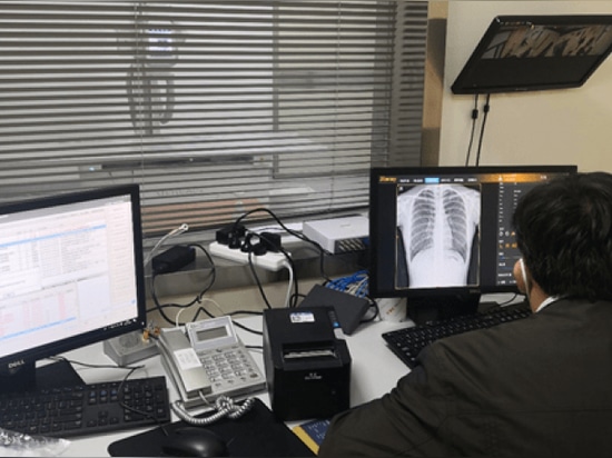 El Hospital Sir Run Run Shaw, afiliado a la Facultad de Medicina de la Universidad de Zhejiang, ha presentado el DR de doble columna de la serie Mednova Staray.