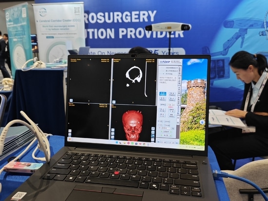 HUIDAMED AACNS 2026 en Manila: impulsando la innovación en neurocirugía
