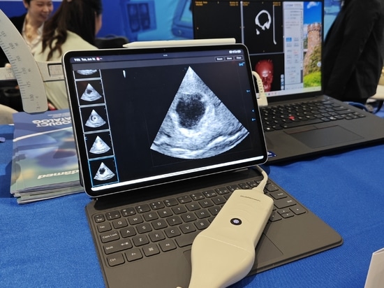 HUIDAMED AACNS 2026 en Manila: impulsando la innovación en neurocirugía