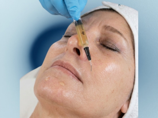 REVYPEEL: el peeling híbrido