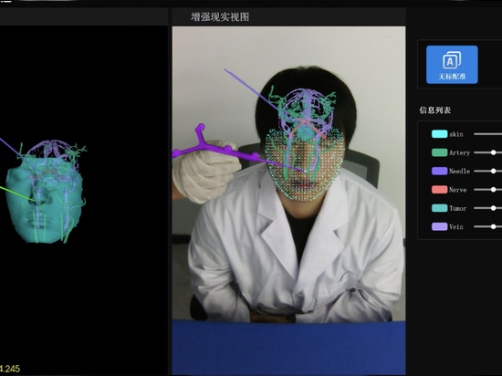 Ruitong SE: seguimiento 3D en tiempo real sin marcadores
