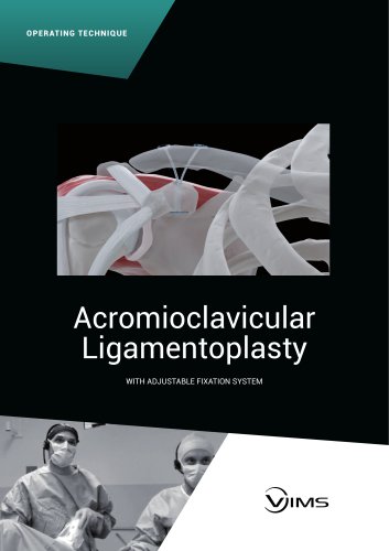 OPERATING TECHNIQUE - ACROMIOCLAVICULAR LIGAMENTOPLASTY