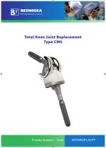 Total Knee Joint Replacement Type CMS