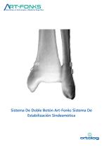 ArtFonks Sistema De Doble Boton_Sindesmotica - 1