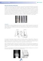 ArtFonks Sistema De Doble Boton_Sindesmotica - 3