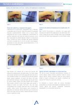 ArtFonks Sistema De Doble Boton_Sindesmotica - 5