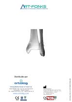 ArtFonks Sistema De Doble Boton_Sindesmotica - 8