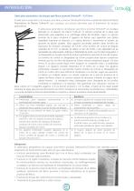 Placa De Bloqueo Para Fémur Proximal Ortholox-4