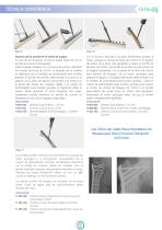 Placa De Bloqueo Para Fémur Proximal Ortholox-7