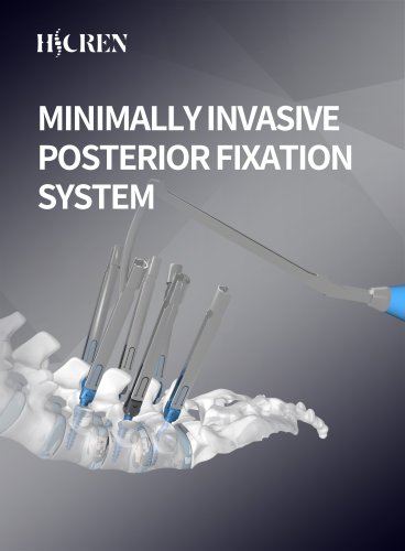Minamally Invasive Posterior Spinal Fixation System