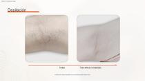 Depilación DPL PLUS + Filtro DPL Cuidado de la piel-15