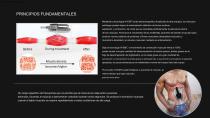 EMS Magshape con 4 asas-5