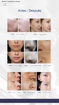 Hydrafacial portátil-7