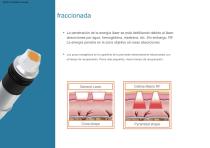 Radiofrecuencia con microagujas-12