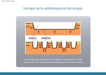 Radiofrecuencia con microagujas-7