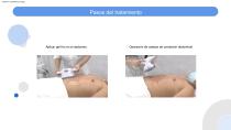 V-shaping-15
