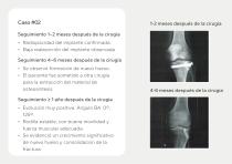 Injertos Óseos – Portafolio-10