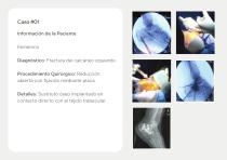 Injertos Óseos – Portafolio-7