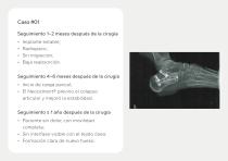 Injertos Óseos – Portafolio-8
