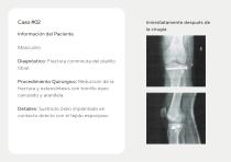 Injertos Óseos – Portafolio-9