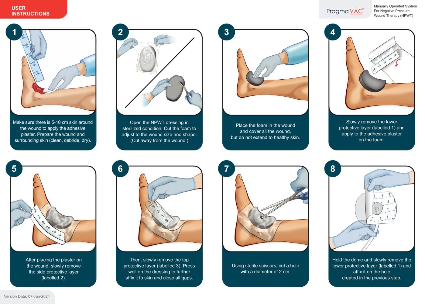 Wound Dressing Application Instuctions - EN - PragmaVAC