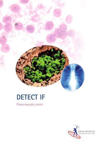 DETECT IF P carinii (FIPC200)