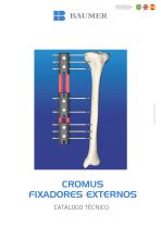 CROMUS FIXADORES EXTERNOS - 1