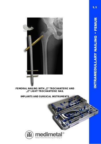 "Z"-trochanteric nailing