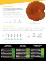 EASYRET, Fotocoagulacion Periférica y Macular - 4