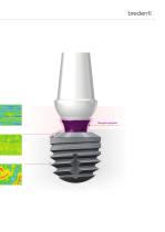 copaSKY – Sistema de implantes-11
