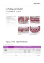 copaSKY – Sistema de implantes-7