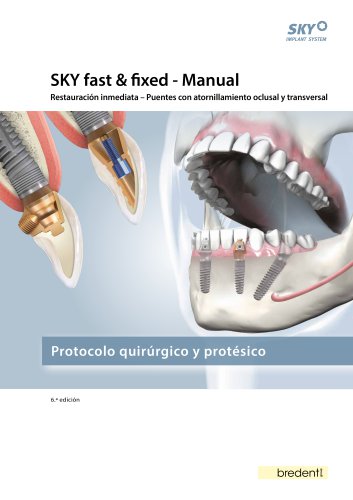 SKY fast & fixed &ndash; Manual