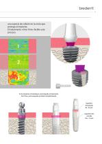 SKY Sistema de implantes – blueSKY, narrowSKY, classicSKY-11