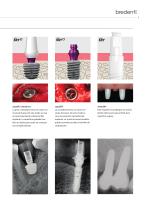 SKY Sistema de implantes – blueSKY, narrowSKY, classicSKY-9