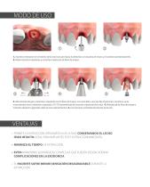 BTI Extractor Radicular - 3